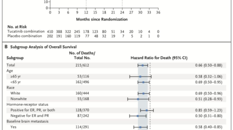亚美尼亚VS波黑比分预测：欧陆劲旅迎战重建之师，天平倾向谁？